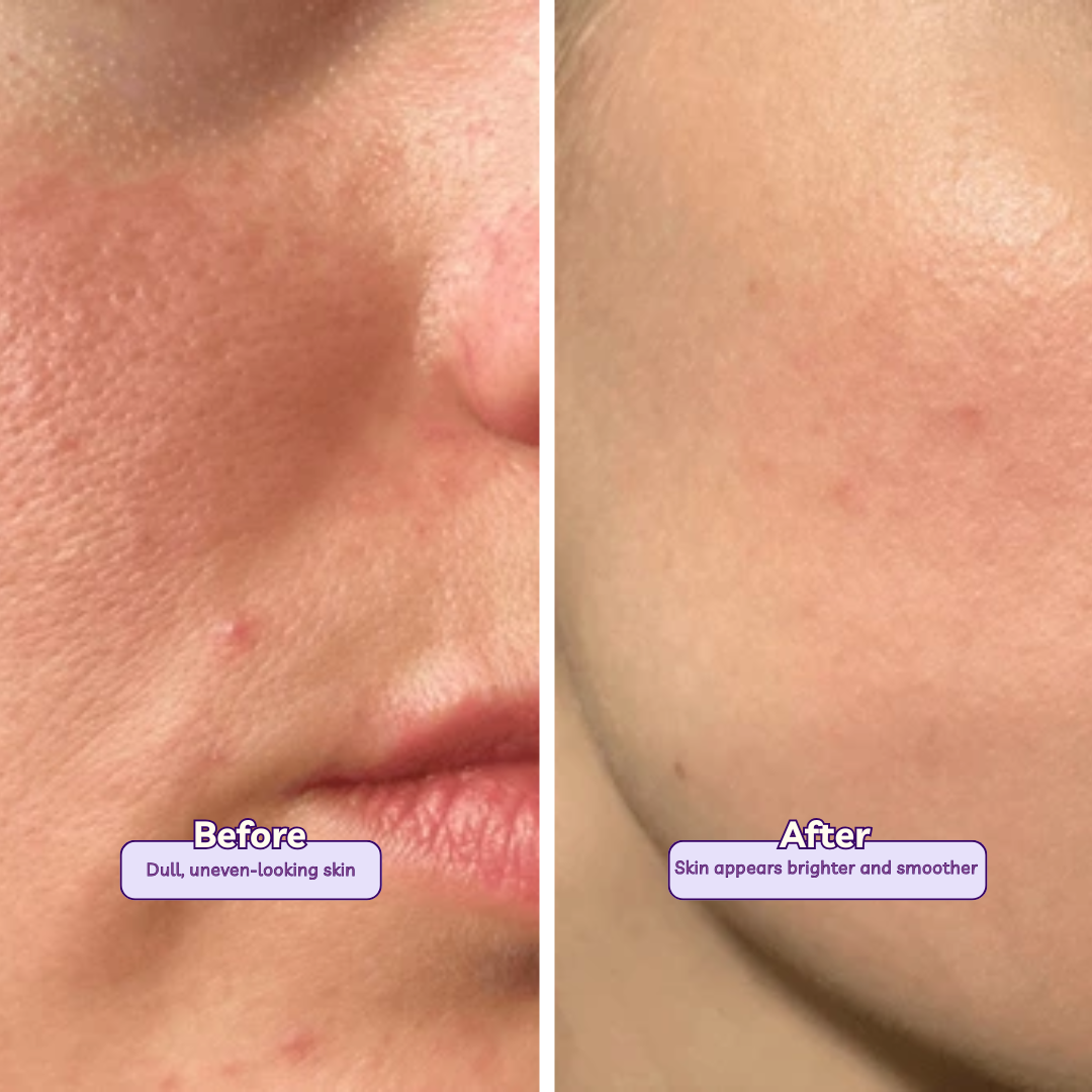 Nano White Face Wash | 1% Kojic Acid and 1% Niacinamide