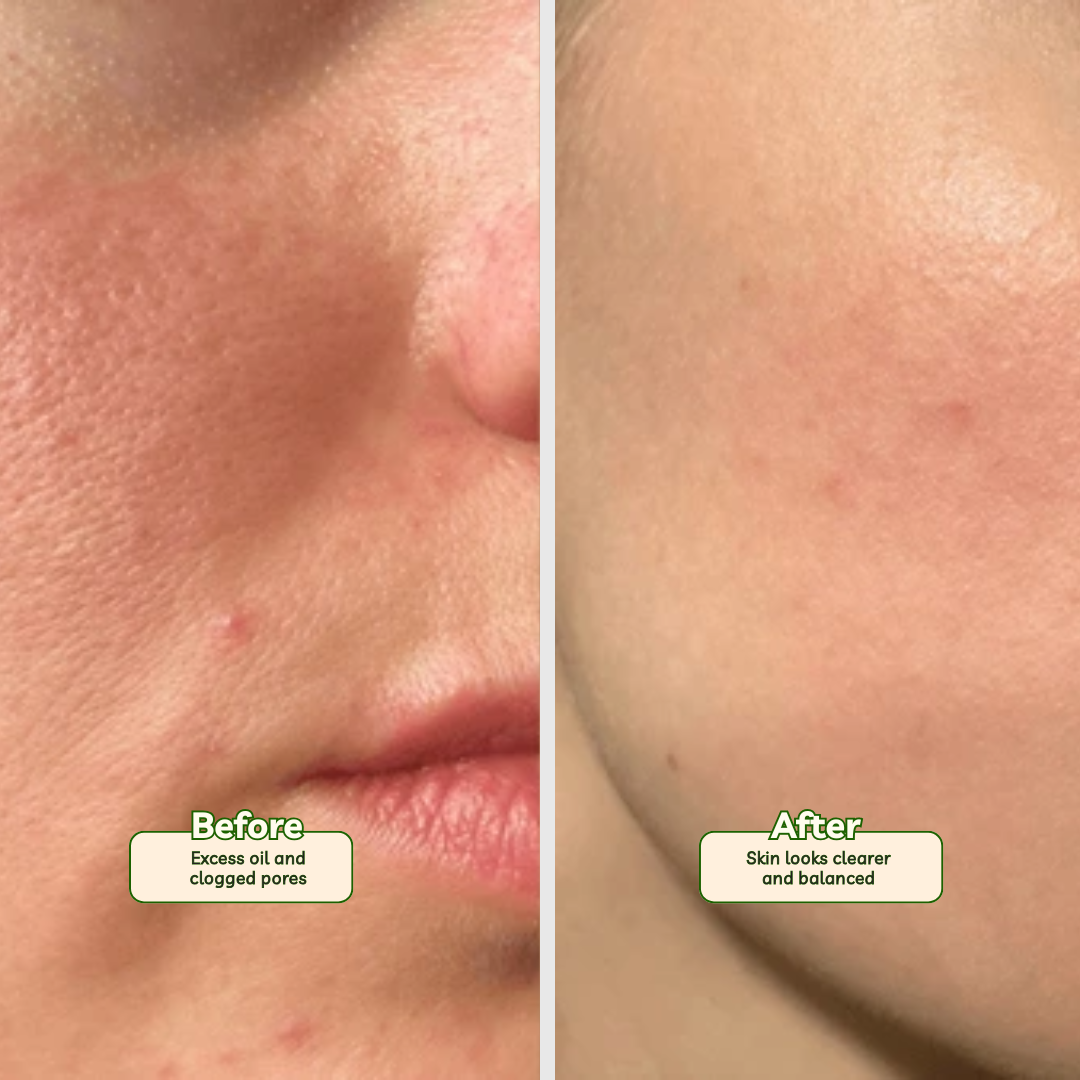 Nano White Face Wash | Oil Control Formula with Salicylic & Glycolic Acid