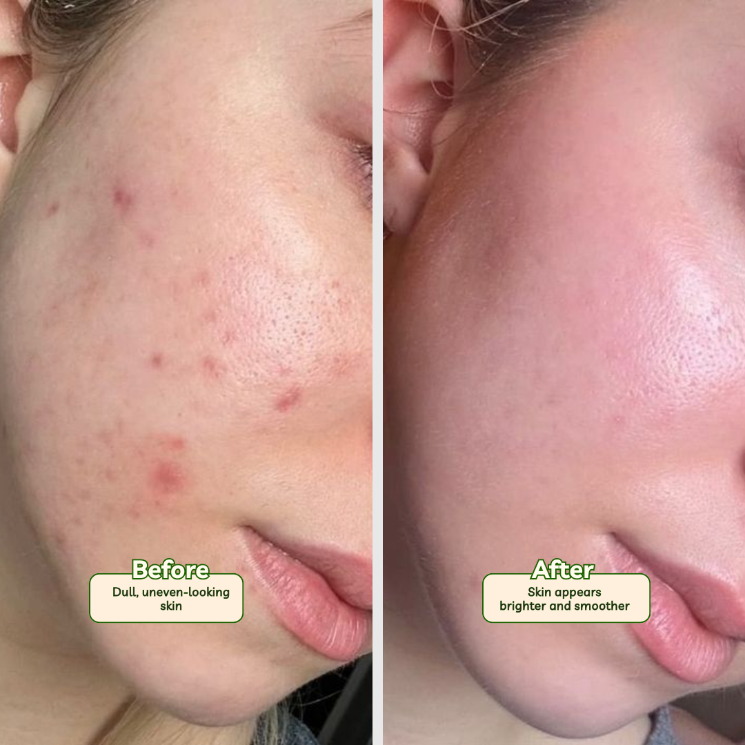 Nano White Salicylic Cream | 3X Whitening & Glowing