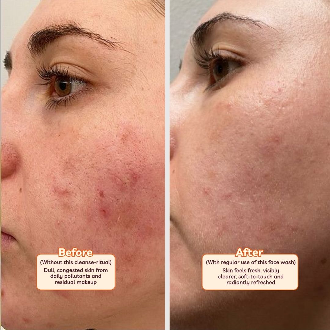 Jasmine Face Wash with Shea Butter for Gentle Detox