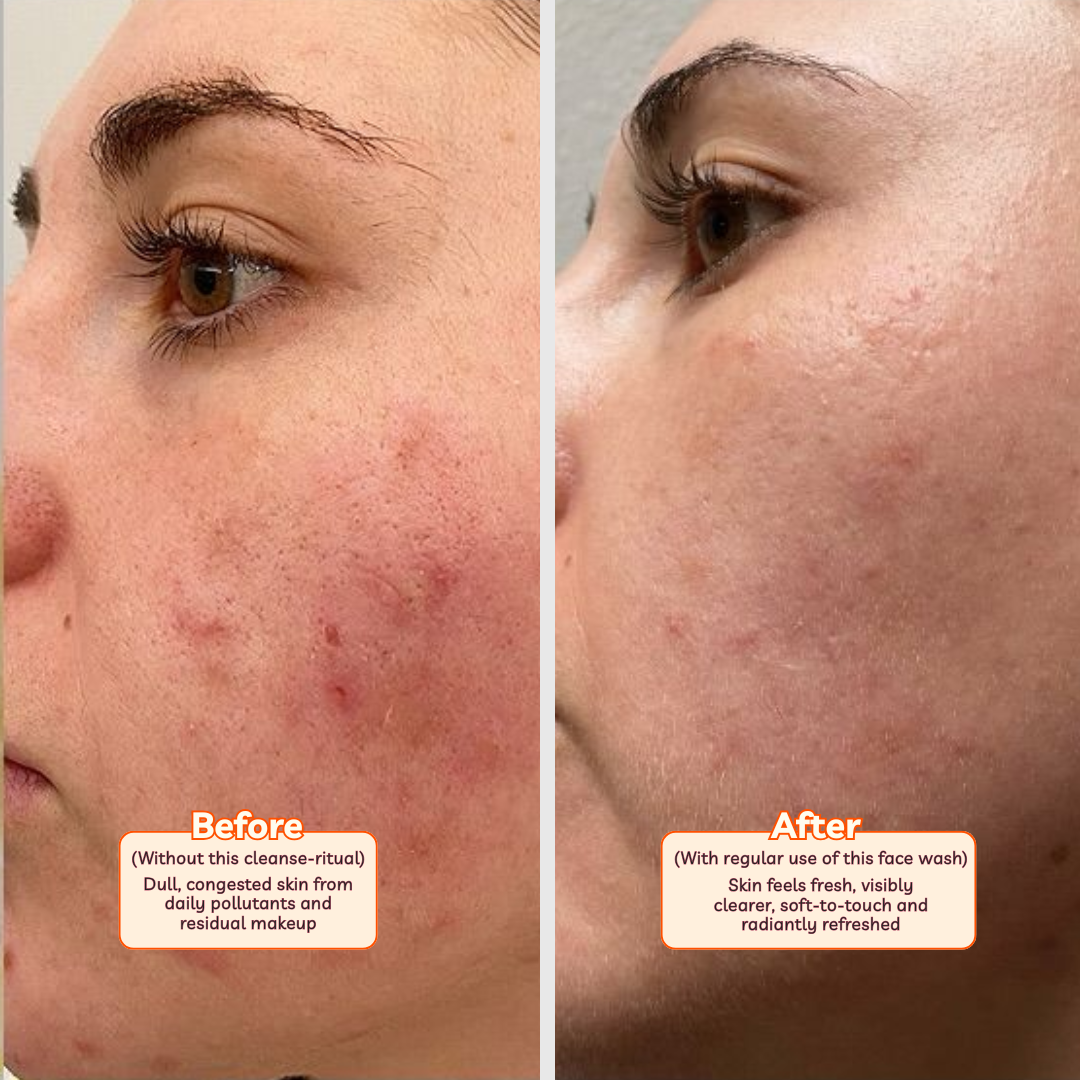 Detoxifying Face Wash | Gracious Jasmine | Spot and Tan clean | Deep Cleansing 100ml