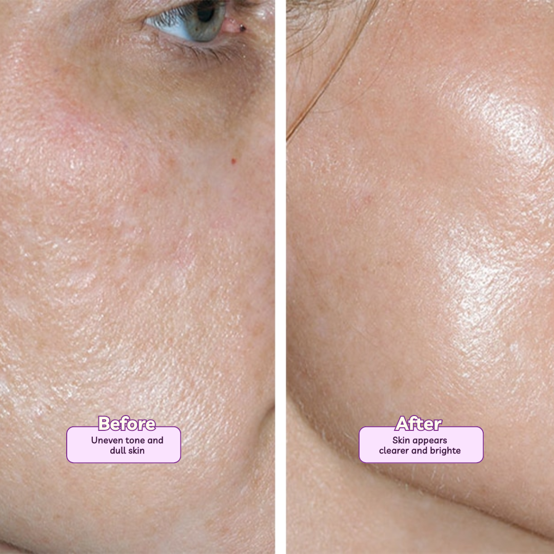 Nano White Soap Pack of 3 | Kojic Acid, Niacinamide & Alpha Arbutin