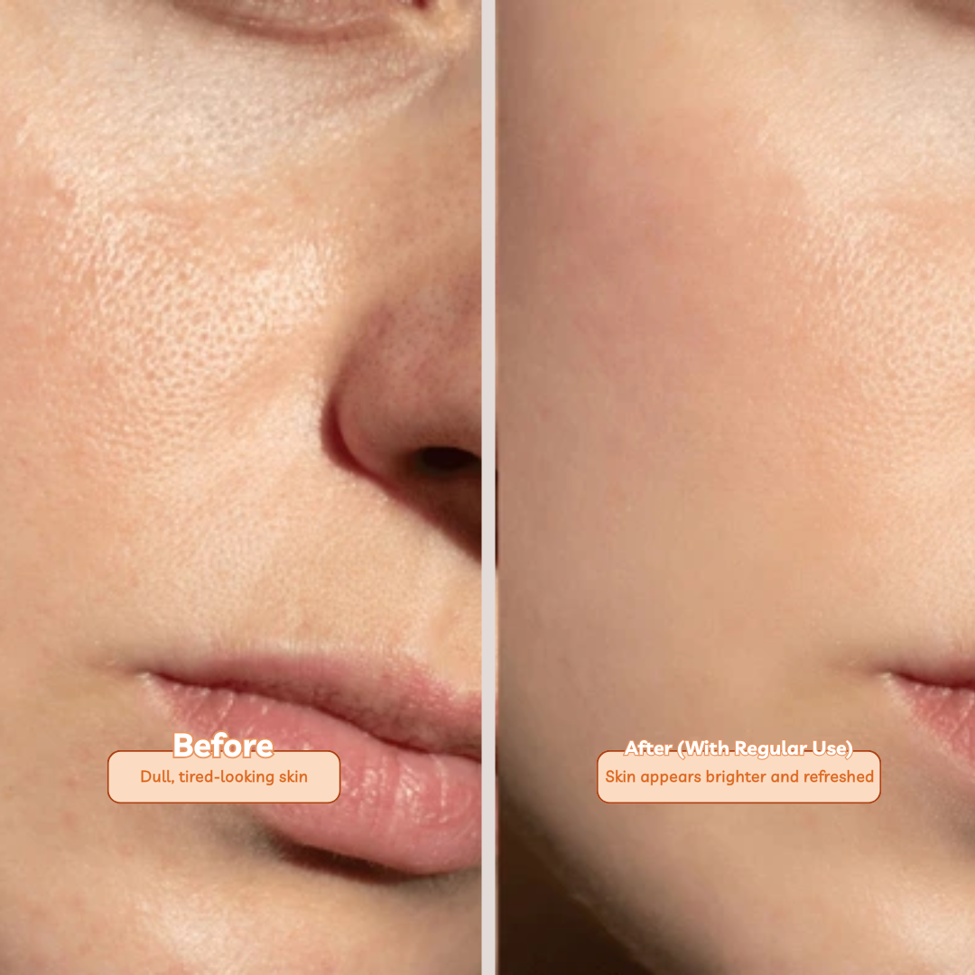 Vitamin C Face Wash with AHA and BHA for Acne Control