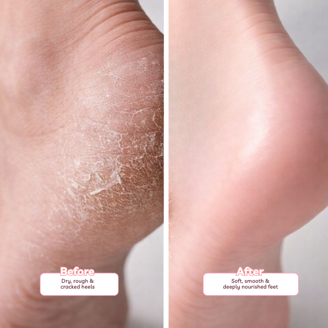 Anaaya Perfect Heels Foot Cream 20g
