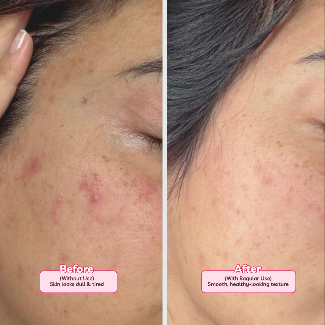 Detoxifying Face Wash | Majestic Rose | Spot and Tan clean | Deep Cleansing 100ml