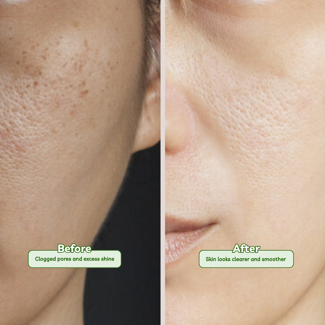 2% Salicylic + 1% Glycolic & Green Tea Foaming Face Wash 100 ml