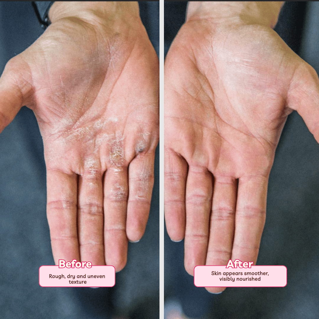 Moisturising Body Butter | Silky soft Majestic Rose | 72-Hour Hydration 100 g